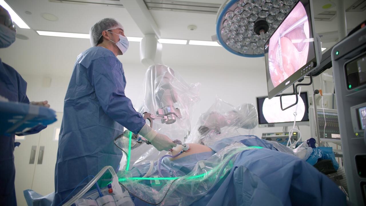 AI-guided autonomous camera assists gall bladder surgery